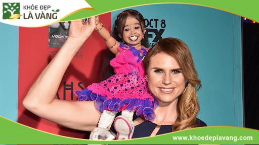 Jyoti Amge là một trong những phụ nữ lùn nhất còn sống hiện nay