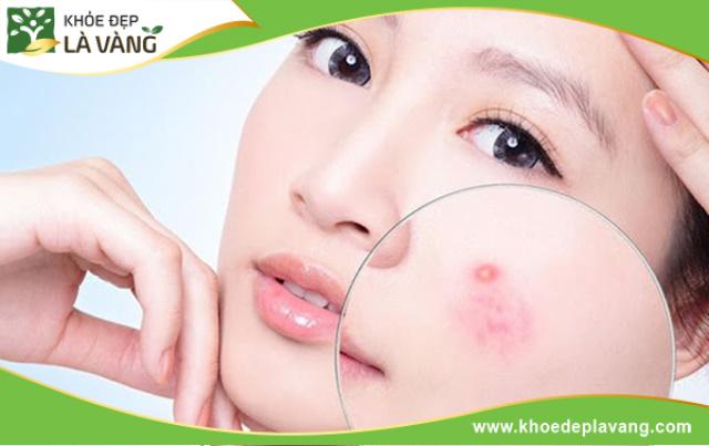 Khi bạn ăn với số lượng lớn và tần suất liên tục sẽ gây mụn và không tốt cho hệ tiêu hóa